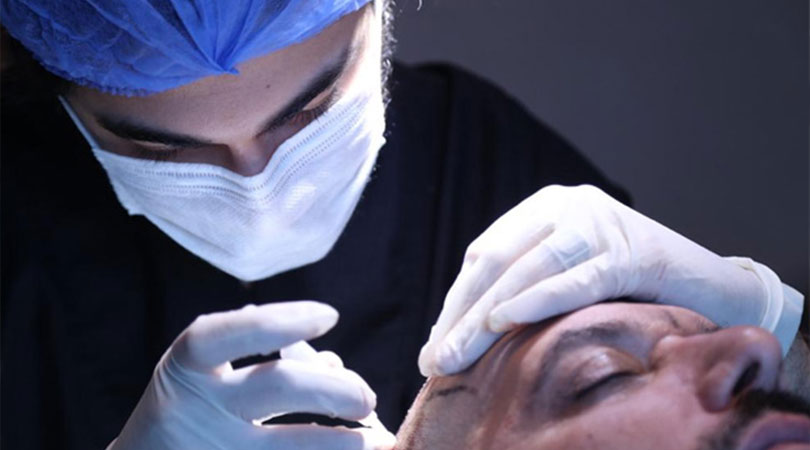 How can we minimize swelling after the hair transplant?