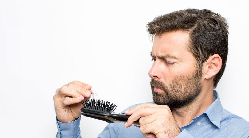 Hair Loss Reasons