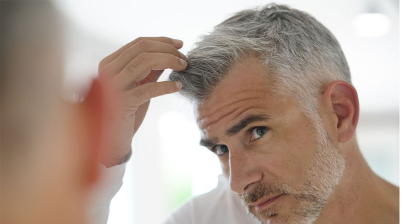 When should hair be shaved after hair transplant?