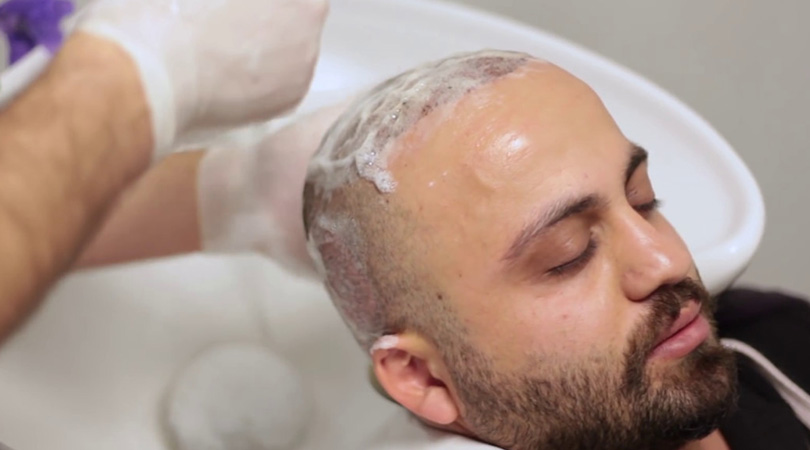 Lavado De Cabello Postoperatorio