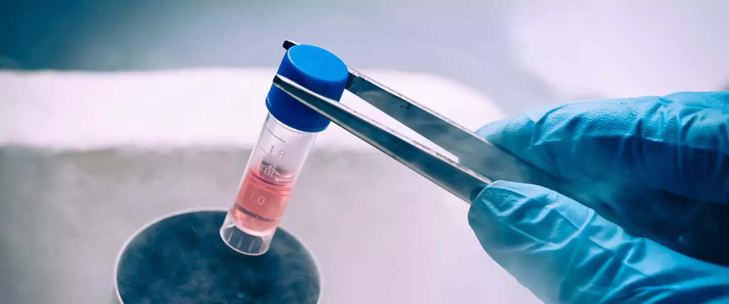 SVF Kök Hücre Tedavisi